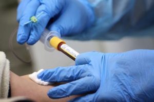 Brazil: 1 tình nguyện viên thử nghiệm vắc-xin Covid-19 của AstraZeneca tử vong
