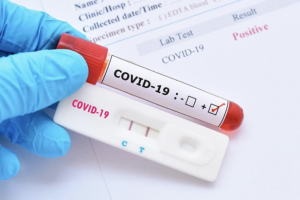 Bộ Y tế: Đang có tình trạng không minh bạch phí xét nghiệm Covid-19, tăng giá so với giá niêm yết