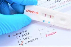 Bộ Y tế lên tiếng về giá bộ test và chi phí xét nghiệm COVID-19